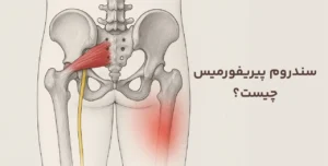 آناتومی سندروم پیریفورمیس